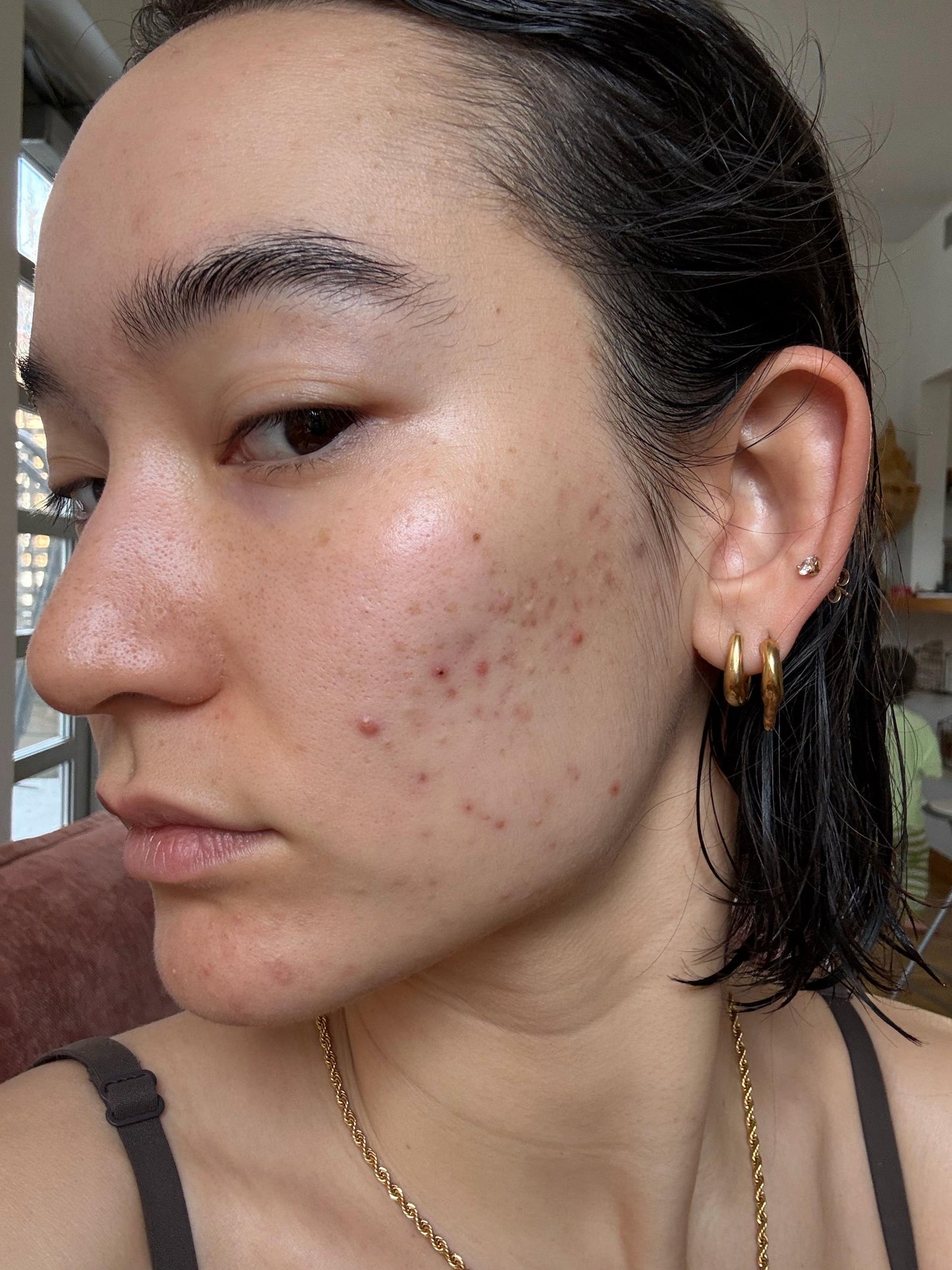 BREAK OUT PRONE SKIN ROUTINE